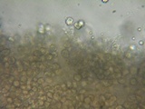 Hydnum umbilicatum image
