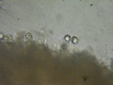 Hydnum umbilicatum image