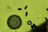 Rosellinia corticium image