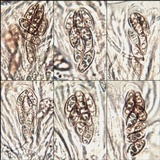 Nephroma laevigatum image