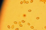 Gautieria monticola image
