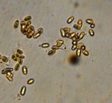 Truncocolumella citrina image