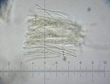 Lanzia echinophila image