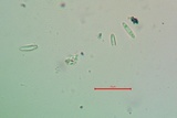 Lecidea laboriosa image