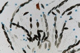 Rosellinia herpotrichoides image