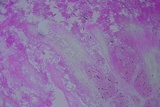 Rhodocollybia maculata image