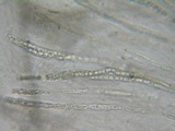 Lasiosphaeria hirsuta image