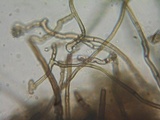 Lasiosphaeria hirsuta image