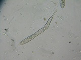 Lasiosphaeria hirsuta image