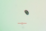 Diplotomma alboatrum image