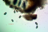 Diplotomma alboatrum image