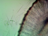 Bacidia laurocerasi image