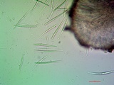 Bacidia laurocerasi image