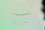 Bacidia laurocerasi image