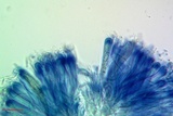 Bacidia laurocerasi image