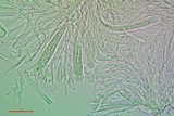 Bacidia laurocerasi image