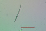 Bacidia laurocerasi image