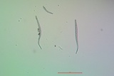 Bacidia laurocerasi image