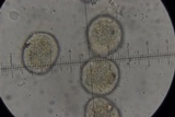 Puccinia lapsanae image