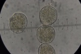 Puccinia lapsanae image