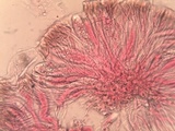 Collema polycarpon image