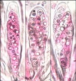 Collema polycarpon image