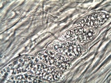 Leptogium lichenoides image