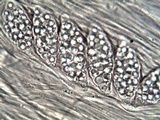 Leptogium lichenoides image