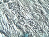 Leptogium lichenoides image