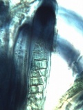 Leptogium lichenoides image