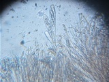 Octospora coccinea image