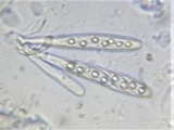 Octospora coccinea image