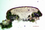 Lecanora hybocarpa image