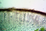 Lecanora hybocarpa image