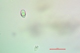 Lecanora hybocarpa image