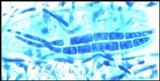 Ophioparma ventosa image