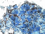 Ophioparma ventosa image