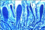 Ophioparma ventosa image