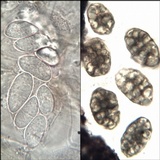 Rhizocarpon reductum image