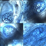 Rhizocarpon reductum image