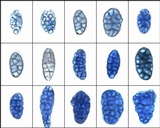 Rhizocarpon reductum image