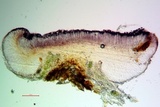 Bacidia heterochroa image
