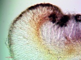 Bacidia heterochroa image