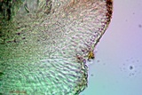 Bacidia heterochroa image