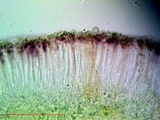 Bacidia laurocerasi image