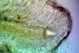 Bacidia laurocerasi image