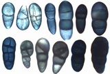 Rhizocarpon lecanorinum image