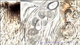 Umbilicaria crustulosa image