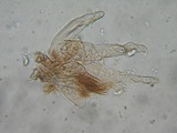 Inocephalus cystomarginatus image