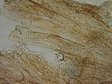 Inocephalus cystomarginatus image